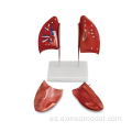 Modelo de anatomía pulmonar izquierda y derecha